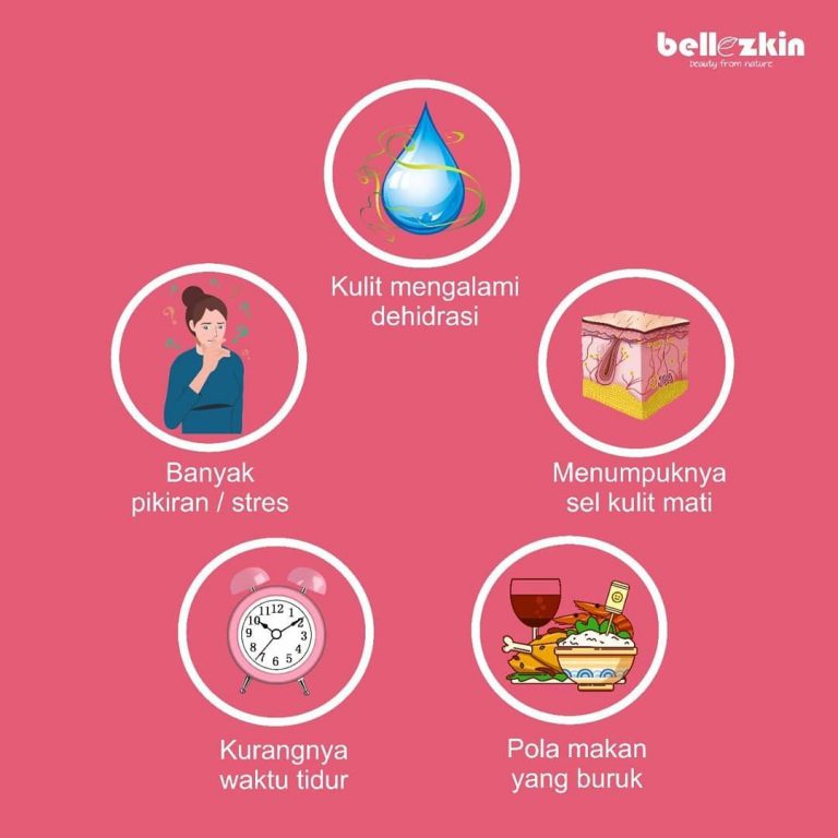 Penyebab Kulit Kusam